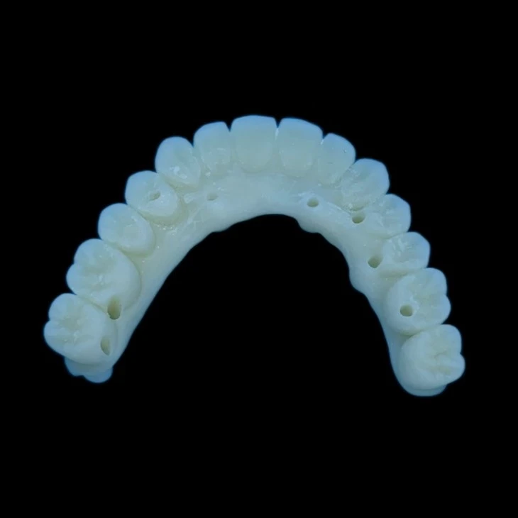 Pont Ddeintyddol Dros Dro PMMA
